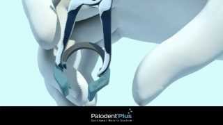 Palodent-Plus-Descripcion-general-tecnica