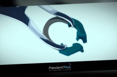 Palodent-Plus-for-Class-II