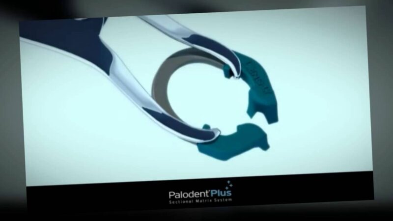Palodent-Plus-for-Class-II