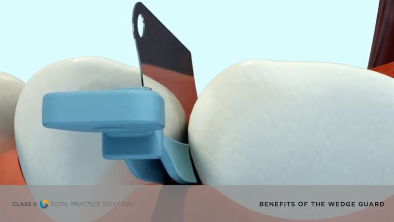 See-the-Benefits-of-the-Palodent-Plus-system-Wedge-Guard-Dentsply-Sirona-Restorative