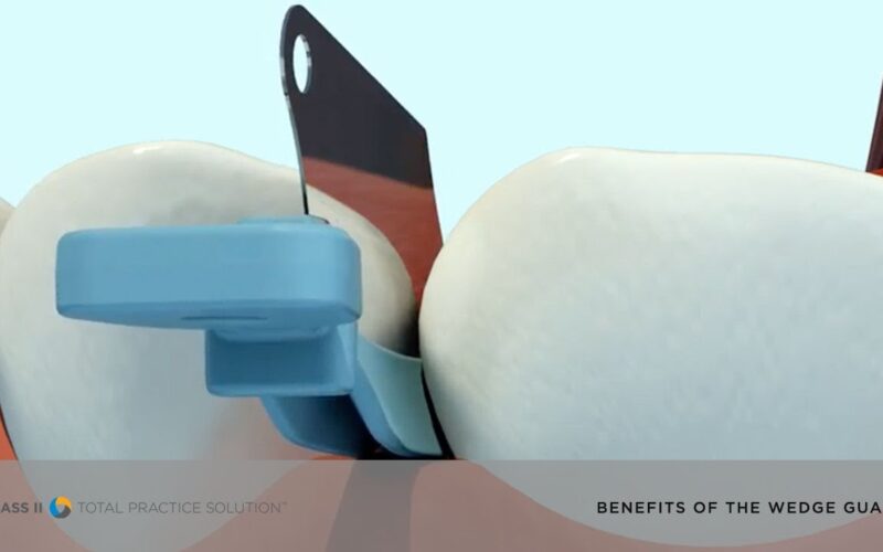 See-the-Benefits-of-the-Palodent-Plus-system-Wedge-Guard-Dentsply-Sirona-Restorative