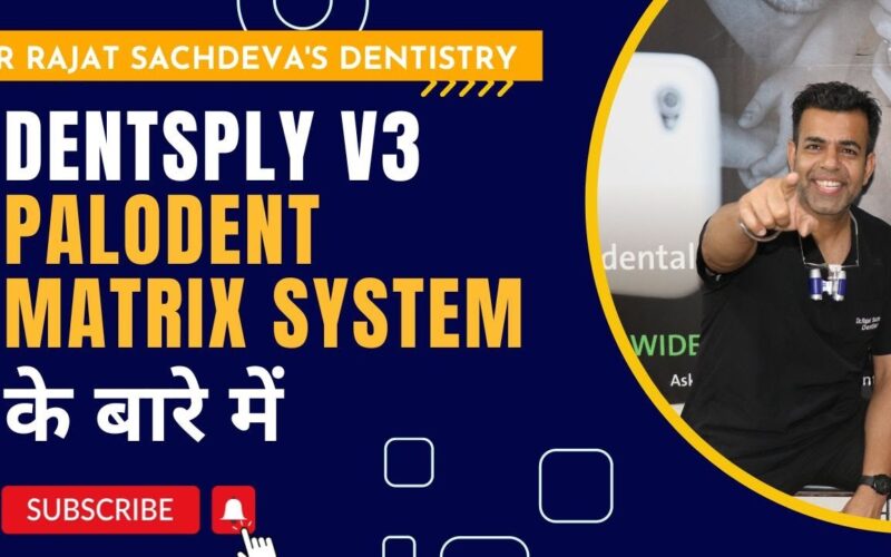 PALODENT-V3-SECTIONAL-MATRIX-SYSTEM