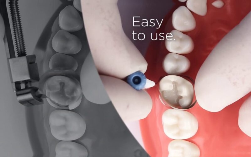 Palodent-360-Comparison-I-Dentsply-Sirona