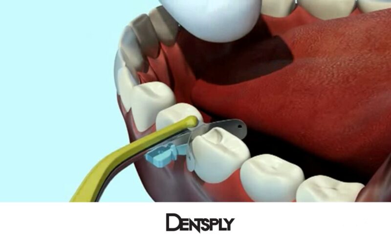 Sistema-de-Matrices-Palodent-V3-de-Dentsply